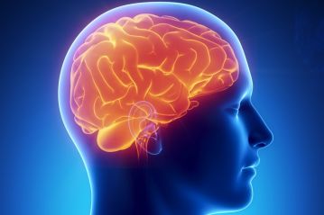 Astrocytoma