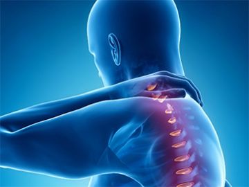 Herniated Intervertebral Disc