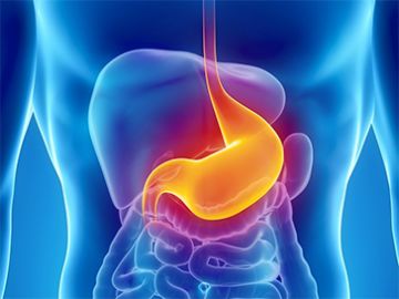 Gastric Ulcer