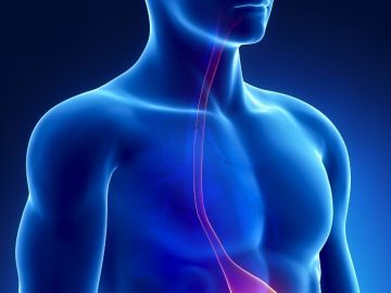 Esophageal Cancer
