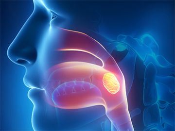 Oral Cancer