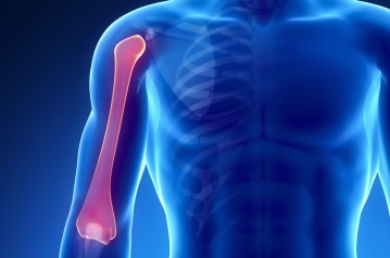 Bone Tumor