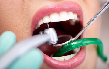 Dental Caries