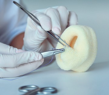 Vaginoplasty