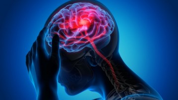 Multiple Sclerosis