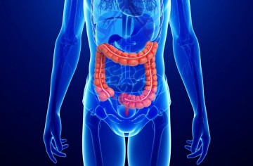 Crohn’s Disease