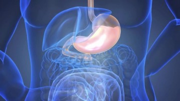 Gastroesophageal Reflux Disease (GERD)