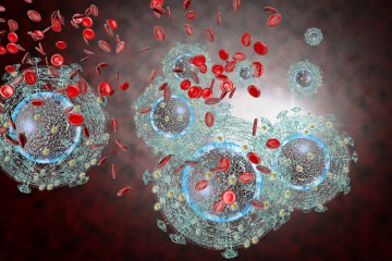 HIV Infection