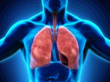 Tuberculosis