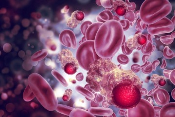 Blood Cancer