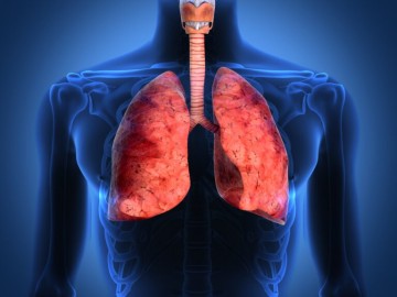 Bronchitis