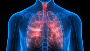 Pulmonary Hypertension