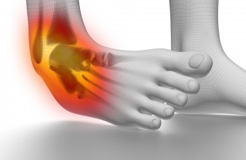 Ligament Injuries