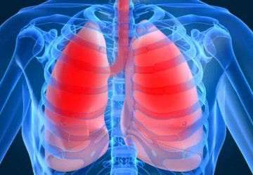 Extrinsic Allergic Alveolitis