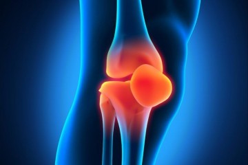 Synovitis