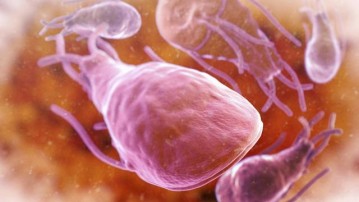Giardiasis