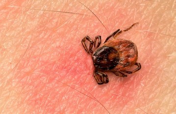 Lyme Disease