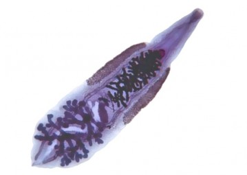 Opisthorchiasis