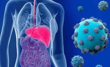 Hepatitis D