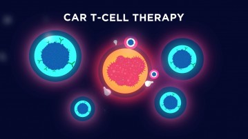 CAR-T therapy