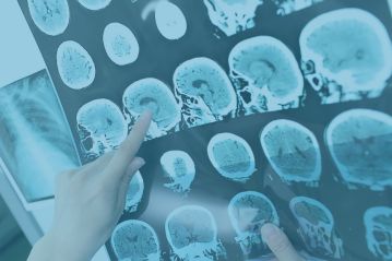 Neurosurgery